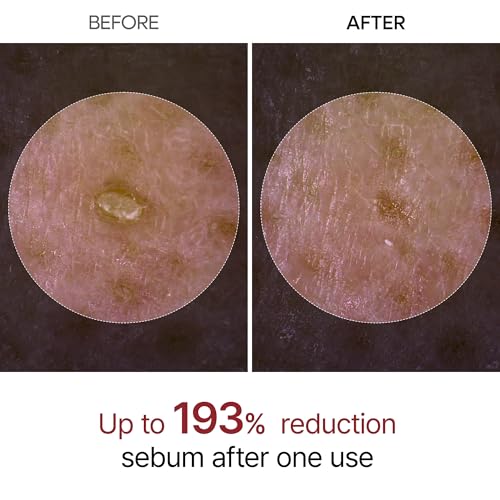 Dr.Melaxin Peel Shot Glow White Rice Peeling Ampoule with Rice Extract & AHA BHA, Brightening & Gentle Exfoliating Serum for Sebum Control, Niacinamide & Hyaluronic Acid, Korean Skincare, 2.71 fl.oz