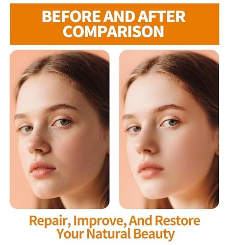 3 Pack Face Serum Skin Care Set-Includes Vitamin C, Hyaluronic Acid & Retinol Serums for Face-Brightening, Anti-Aging,Hydrating Facial Serums-AM, PM & All-Day Skincare Routine