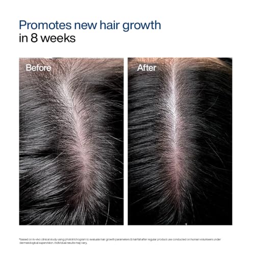 WishCare Hair Growth Serum Concentrate - Rosemary, 3% Redensyl, 4% Anagain, 2% Baicapil, Caffeine, Biotin, Plant Keratin & Rice Water