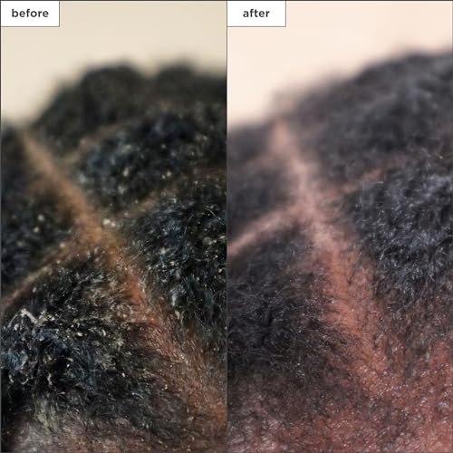 Briogeo Scalp Revival Charcoal + Tea Tree Scalp Treatment | Leave-In Serum