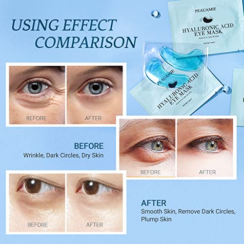 PEAUAMIE Under Eye Patchs Hyaluronic Acid Eye Mask for Dark Circles and Puffiness Wrinkle Eye Bags 30 Pairs