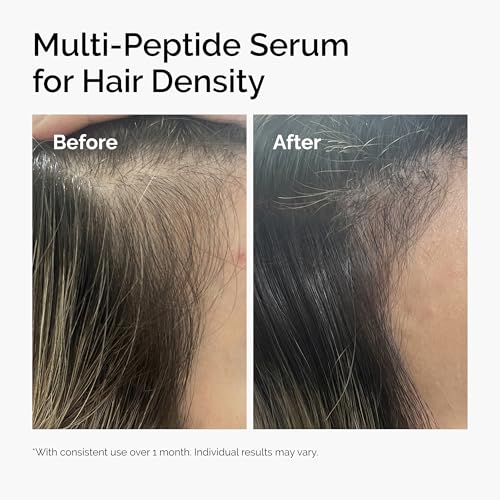 The Ordinary Multi-Peptide Serum for Hair Density, Peptide-Powered Formula for Thicker, Fuller Looking Hair, 2 Fl Oz