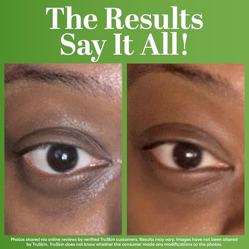 TruSkin Peptide Eye Cream Gel for Dark Circles, 0.5 fl oz