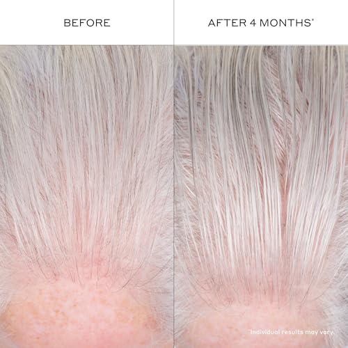 Zenagen Densifying Hair Serum | Boosts Hair Density 1.7 Fl Oz