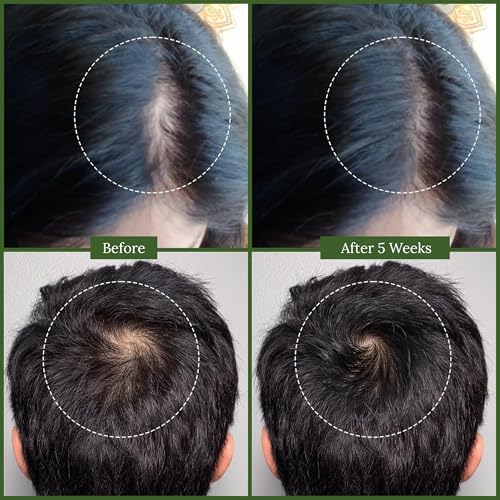 BASIC AYURVEDA Bhringraj Oil for Hair Growth | 3.38 Fl Oz (100ml) | Strengthens Roots & Reduces Hair Loss | Natural Ayurvedic Herbal Oil for Dandruff Control & Scalp Nourishment