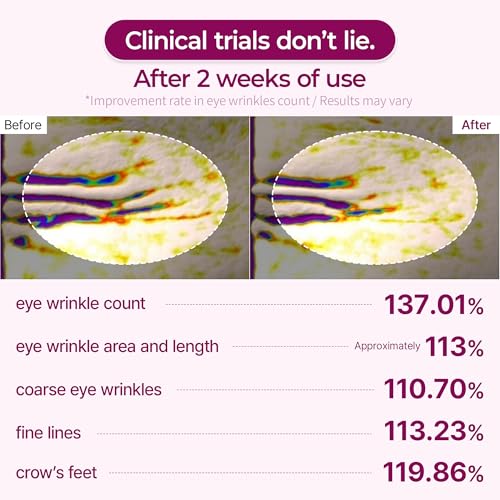 Dr.Melaxin Calcium Volume Under Eye Patches for Puffy Eyes & Dark Circles, Hydrogel Eye Mask for Wrinkles, Fine Lines & Sagging Skin, Firming Collagen Eye Patch, Korean Skin Care (60 Count)