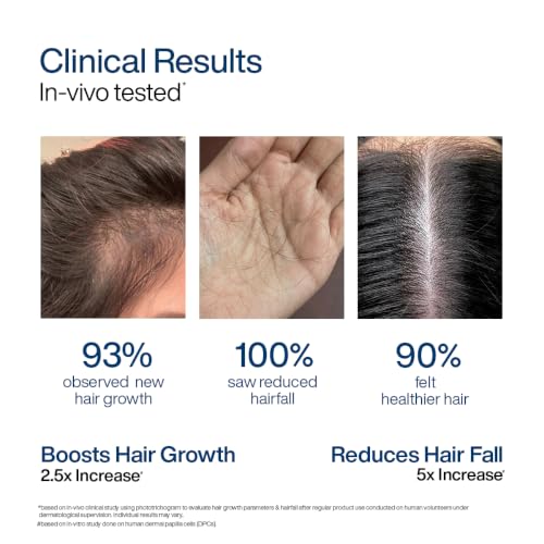 WishCare Hair Growth Serum Concentrate - Rosemary, 3% Redensyl, 4% Anagain, 2% Baicapil, Caffeine, Biotin, Plant Keratin & Rice Water