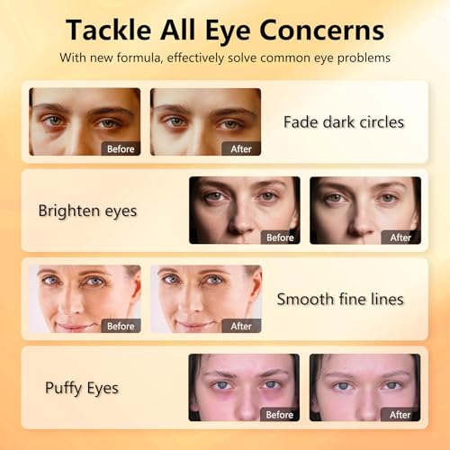 Aeryea Vitamin C & Caffeine Under Eye Patches for Men & Women 30 Pairs