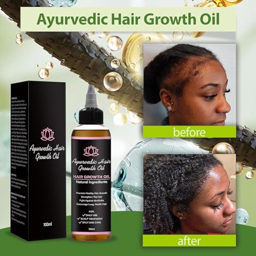 Lifewithqueenp Hair Care Growth Oil, Ayurvedic Hair Growth Oil, Lightweight Natural Herbs Scalp Oils for All Hair Types (1)