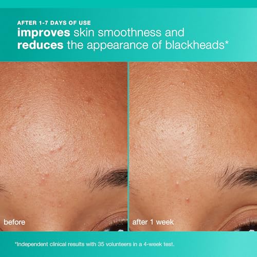 Dermalogica Clear and Brighten Kit, Travel Size