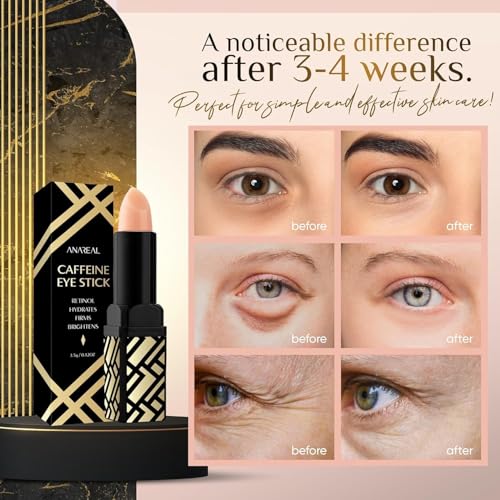 ANAREAL Caffeine Under Eye Balm Stick (1 Pack) – Hydrating Eye Care for Dark Circles & Puffiness, Cooling Eye Balm Stick for Eyes, Face & Under Eye Bags