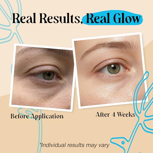 2 Pk 20g Under Eye Balm Stick Hydrating | 0.7 Oz Moisturizing Under Eye Brightener Stick w/Retinol, Aloe Vera, Vit E | Plumps, Hydrates & Reduces Dark Circles & Puffiness | Multipurpose Undereye Balm