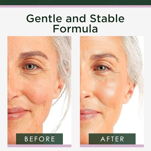 Tree of Life Retinol Serum for Face, Anti Aging Face Oil, 2 Fl Oz