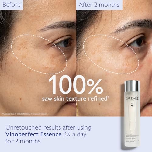 Caudalie Vinoperfect Brightening Essence, Glycolic Acid Toner - 150 mL