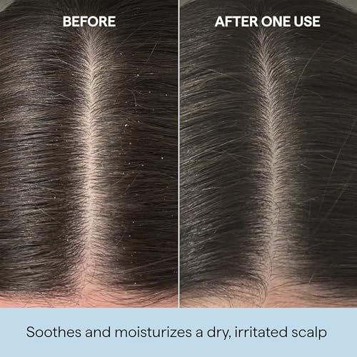 Briogeo Scalp Revival Rosemary Pre-Wash Oil | Moisturizing Scalp Treatment