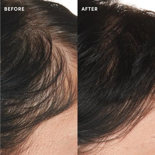 OUAI Scalp Serum - Balancing Hair Serum (2 Fl Oz)