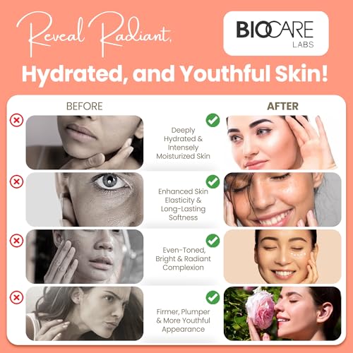 Biocare Body Butter - Infused with Cocoa Butter & Shea Butter plus Alpha-Bioplex for Youthful-Looking, Radiant Complexion, Hydrated, Smoother, Firmer Skin - Without Paraben and Sulfate -16 Oz