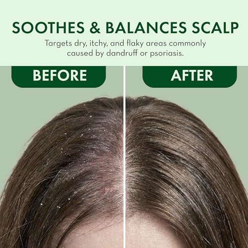 Leave In Conditioner Spray - Rosemary & Mint Scalp Treatment