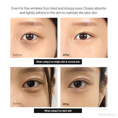 Dr.Melaxin Calcium Dark Spot Eye Cream 15g – Niacinamide & Calcium Gluconate Eye Cream for Dark Circles, Under Eye Bags & Sagging | Hydrolyzed Elastin EX Volume Firming | Korean Eye Cream