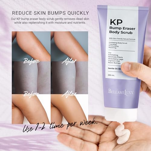BellamiLuxx KP Bump Eraser Body Scrub: Exfoliating Keratosis Pilaris, Strawberry Skin Treatment - Smooths Rough, Bumpy, Dry Skin on Arms, Legs, Buttocks - KP Scrub Wash Helps Reduce Ingrown Hair Bumps