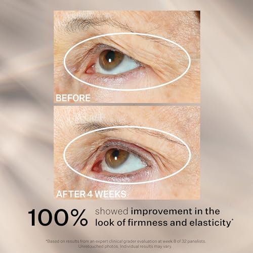 StriVectin Peptight® 360° Tightening & Brightening Eye Serum, 1 oz