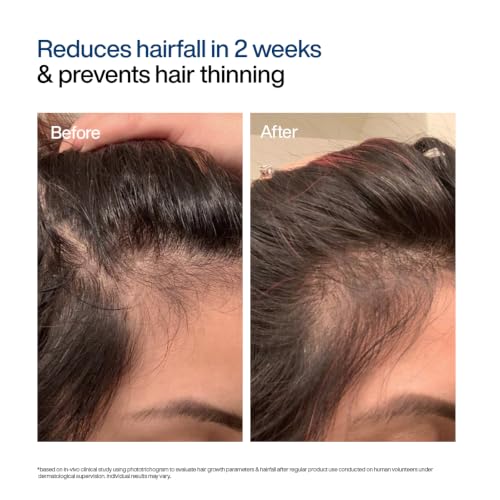 WishCare Hair Growth Serum Concentrate - Rosemary, 3% Redensyl, 4% Anagain, 2% Baicapil, Caffeine, Biotin, Plant Keratin & Rice Water