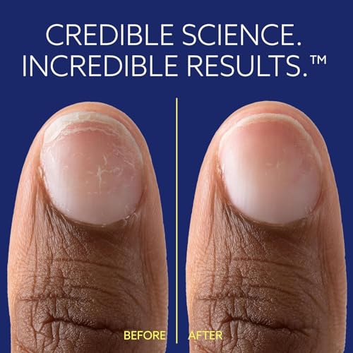 ePhD Bond Repair Nail Treatment, Nail Repair that Strengthens, Restores & Rebuilds Brittle Nails, Strengthens from Within, Formula for Damaged, or Post-Gel Nails, Use Alone or as a Polish Base