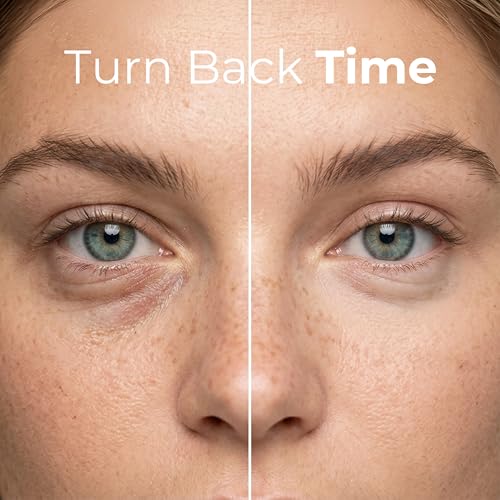 LIVAURA Retinol Eye Gel - Under Eye Cream for Dark Circles, Puffiness, Bags