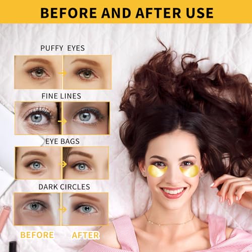 24K Gold Eye Masks for Dark Circles and Puffiness 70PCS, Under Eye Patches for Puffy Eyes Treatment, Under Eye Gel Pads w/ Collagen, Caffeine, Peptides for Eye Bags Treatment, Gel Eye Mask Skincare