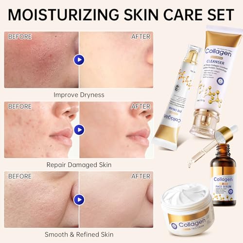 Collagen Skin Care Set, Anti Aging Skincare Set for Reduce Wrinkles, Shrink Pores, Smooth Fine Lines, Hydrating, 4 Pcs Travel Skincare Kits for Women with Cleanser, Serum, Cream, Eye Cream.