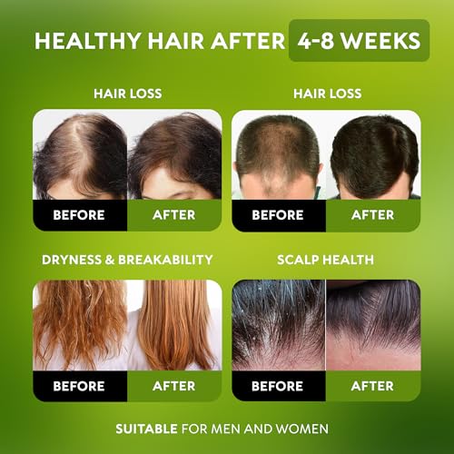 Batana Oil for Hair Growth - 100% Raw & Organic Unrefined Batana Oil - Cold Pressed Hair Mask for Scalp Health, Thicker Hair & Split Ends Repair - Natural & Pure (4.23 oz)