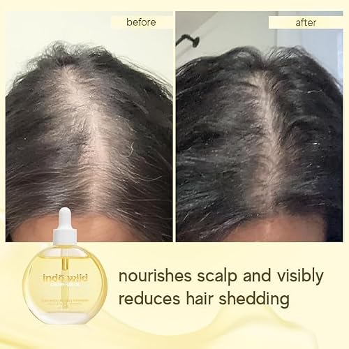Indē wild Champi Hair Oil, Miracle Oiling Treatment, 16+ Ayurvedic Actives, Targets Dandruff, Strengthens Roots, 1.7 fl oz