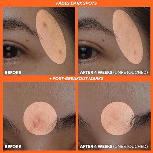 Innisfree Green Tea Enzyme Vitamin C Serum for Brightening | Sunspots, Post-Breakout Marks and Dark Spot Correction | Hydrating Korean Face Serum for Radiant Glow, 1.01 Fl Oz