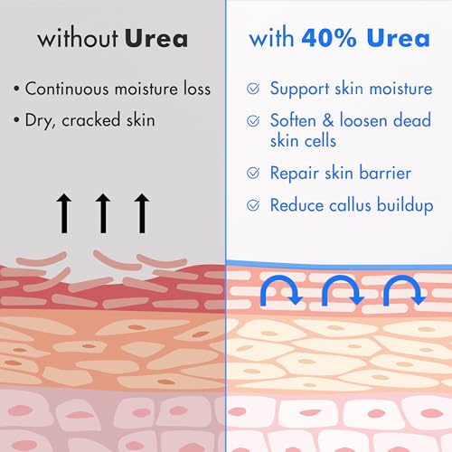 Ebanel Urea Cream 40% plus Salicylic Acid 2% for Dry Cracked Feet Skin