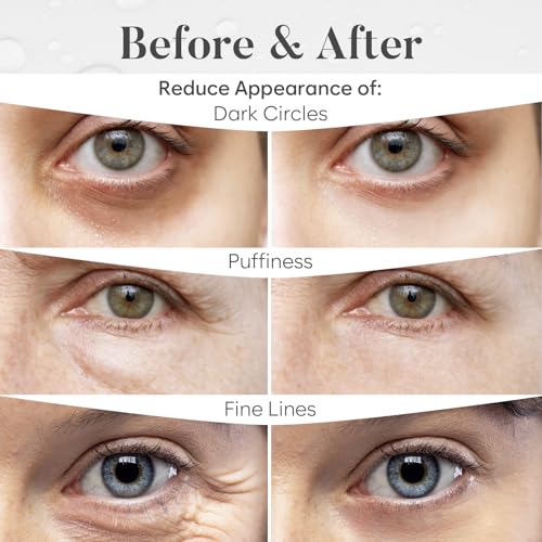 BLOOMORA Variety Under Eye Patches (30 Pairs) - Dark Circles & Puffy Eyes Care - Eye Care Mask for Refreshment - 5 Varieties
