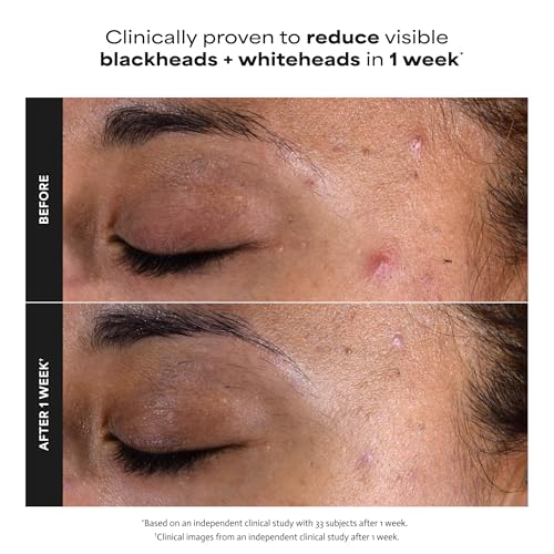 Paula's Choice SKIN PERFECTING 2% BHA Liquid Exfoliant, 1 Fl Oz