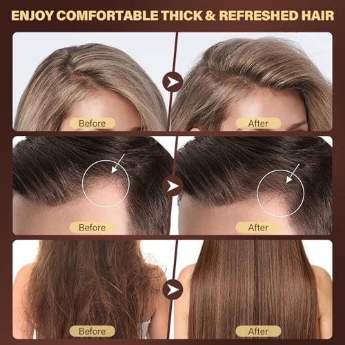 Scalp Scrub for Hair Growth, Scalp Exfoliator with Batana Oil & Rosemary, Deep Scalp Cleanser with Scalp Massager, 2-in-1 Clarifying Shampoo Hair Treatment, Buildup Removal, Itchy Relief, 10.93 oz