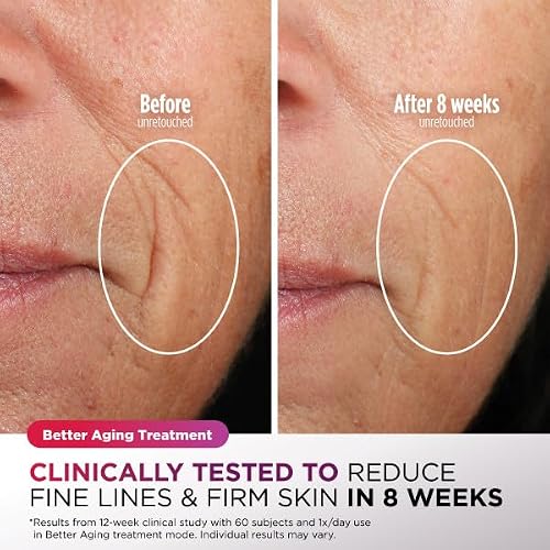 Shark CryoGlow LED Face Mask in Rose Glow, FW312PK