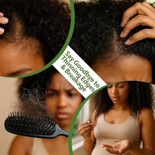 Lifewithqueenp Hair Care Growth Oil, Ayurvedic Hair Growth Oil, Lightweight Natural Herbs Scalp Oils for All Hair Types (1)