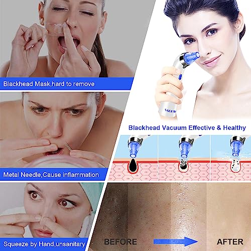 Blackhead Remover Pore Vacuum, Face Suction Pore Cleaner, 5 Suction Power Electric Blackhead Suction Remover, Extractor Tool, 4 Probes for Women & Men (Blue）