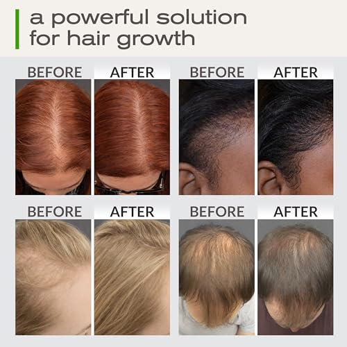 Hair Growth Oil with Rosemary, Castor & Biotin, Dry Scalp Treatment, 2 Oz