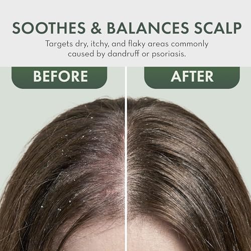 Leave In Conditioner Spray - Tea Tree Scalp Treatment