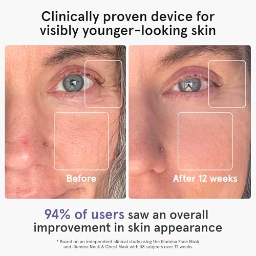 iRestore LED Face Mask for Youthful Skin, Red Light Therapy for Face, Red, Blue & Infrared Therapy for Wrinkles, Fine Lines, Dark Spots with 360 LEDs, Skincare Device for Women & Men