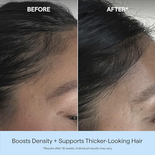 Briogeo Destined for Density Caffeine + Biotin Peptide Density Serum | Increases Hair Thickness & Volume for Fine or Thinning Hair | Fast-Absorbing & Non-Greasy | Fragrance-Free | Vegan & Cruelty-Free