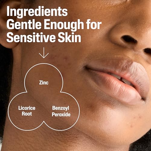 Cetaphil Gentle Clear BPO Acne Face Wash, Soothing, Sensitive Skin, 4.2 fl oz