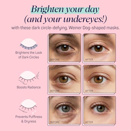 SpaLife So Fetch Hydrogel Under Eye Patches for Dark Circles | Dachshund Under Eye Patches for Puffy Eyes | Weiner Dog Undereye Bags and Puffiness Removal | Bachelorette Party Favors | 8 Pairs