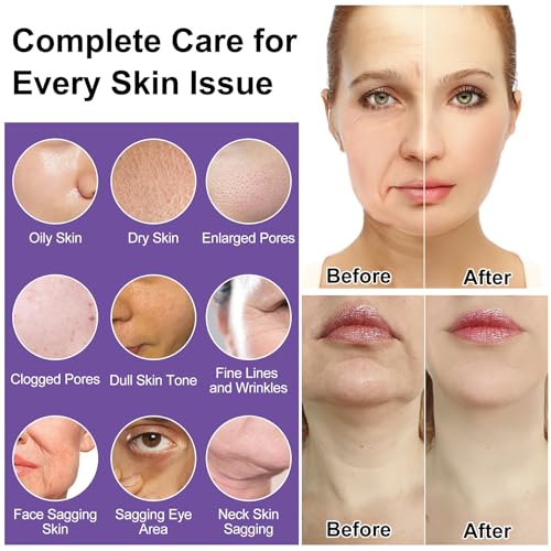 Skin Care Set,6Pcs Tighten, Lift, Firm, Hydrate & Radiant Facial Skincare