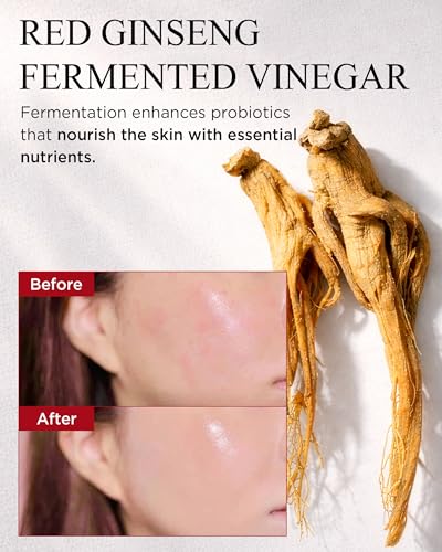 DANAHAN Bonyongo Red Ginseng Vinegar Toner, Niacinamide, Dry Skin, 5 fl oz