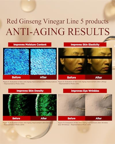 DANAHAN Bonyongo Red Ginseng Vinegar Toner, Niacinamide, Dry Skin, 5 fl oz
