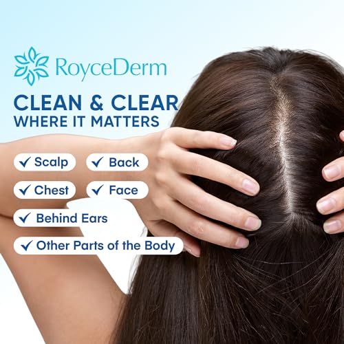 Roycederm Seborrheic & Psoriasis Calming Serum: Clinically Inspired Care for Itch, Dryness, Redness & Flaking - Seborrheic Dermatitis & Psoriasis Scalp Treatment Suitable for Scalp, Face & Body